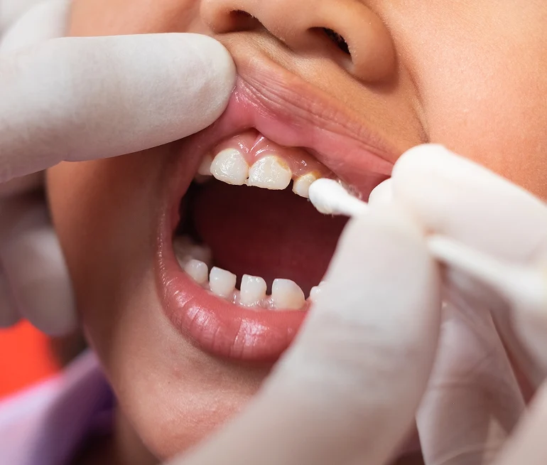 Stronger, Healthier Smiles at Ontario Children’s Dentist